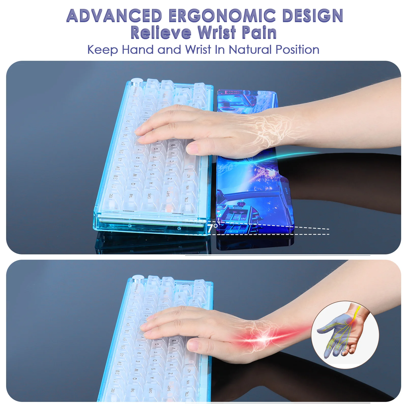 ATTACK SHARK Acrylic Wrist Rest with Pattern - Image 5